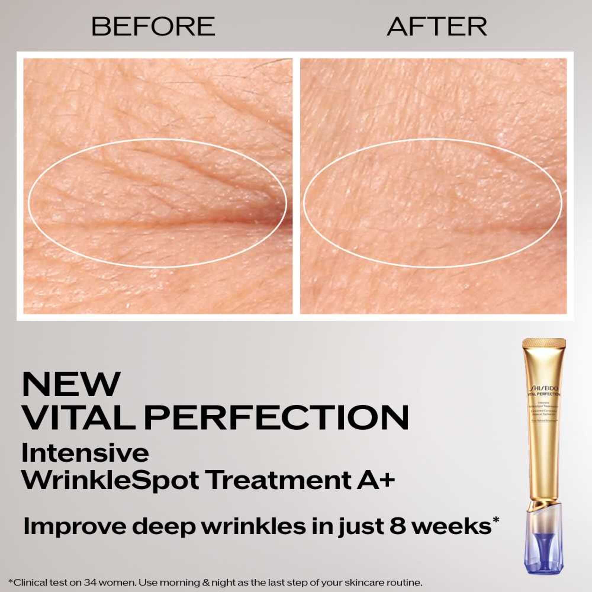 Intensive Wrinklespot Treatment A+