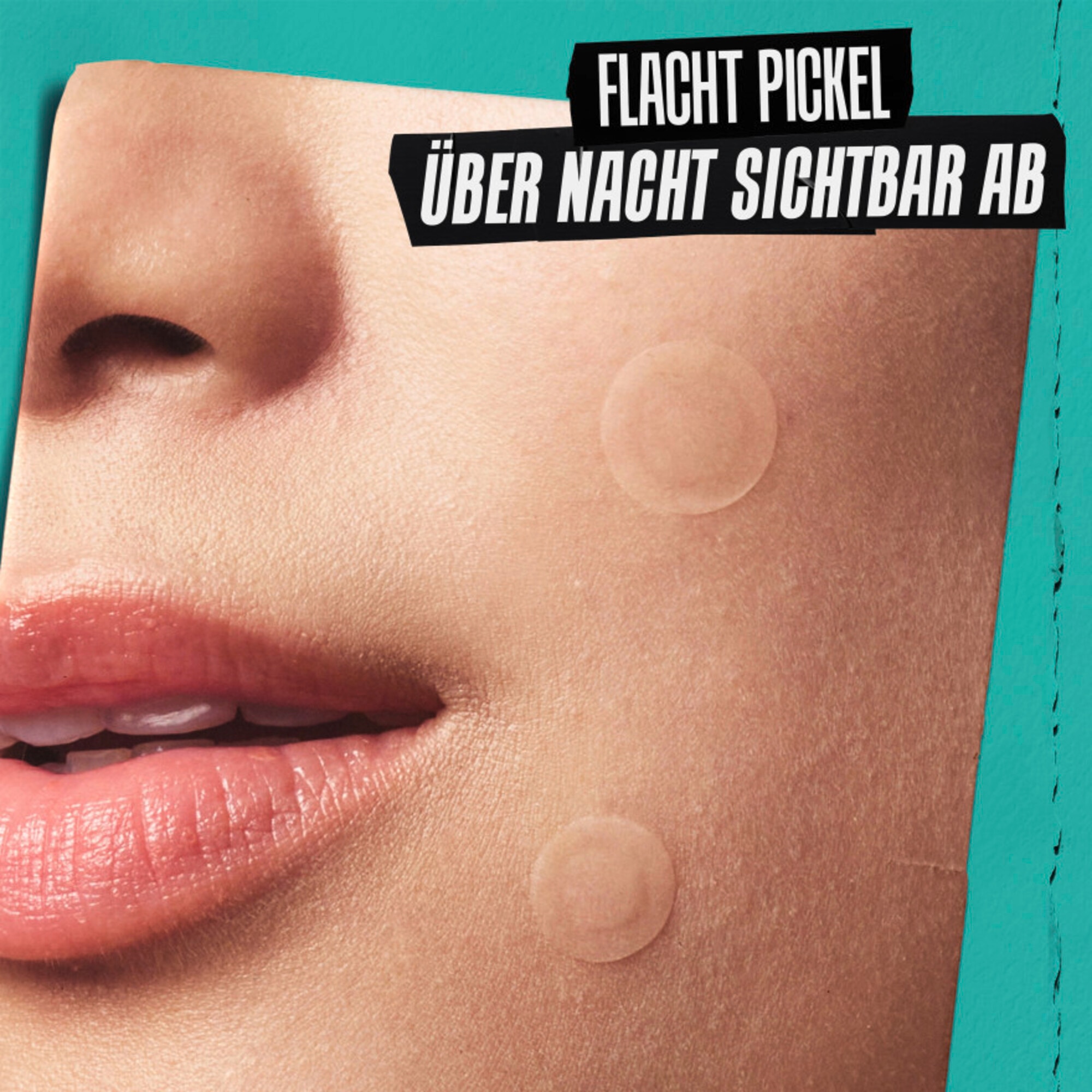 1 PCS Kiehl's Truly Targeted Overnight Blemish Patches Gesichtspflege 1 of 6