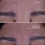 30 ML Lancôme RENERGIE COLLAGEN LIFT XTEND undefined  5 of 8 