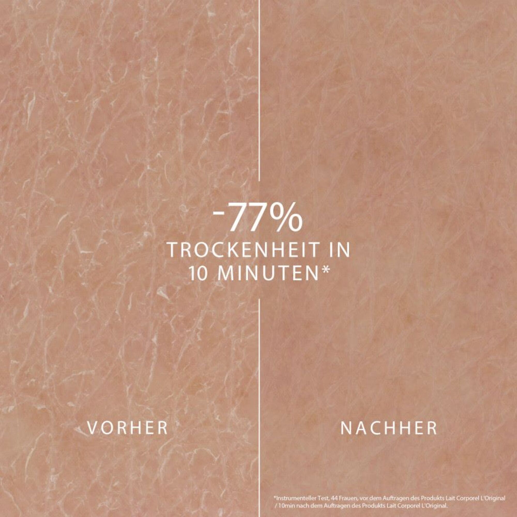 LAIT CORPOREL CONTRE LA PEAU SÈCHE