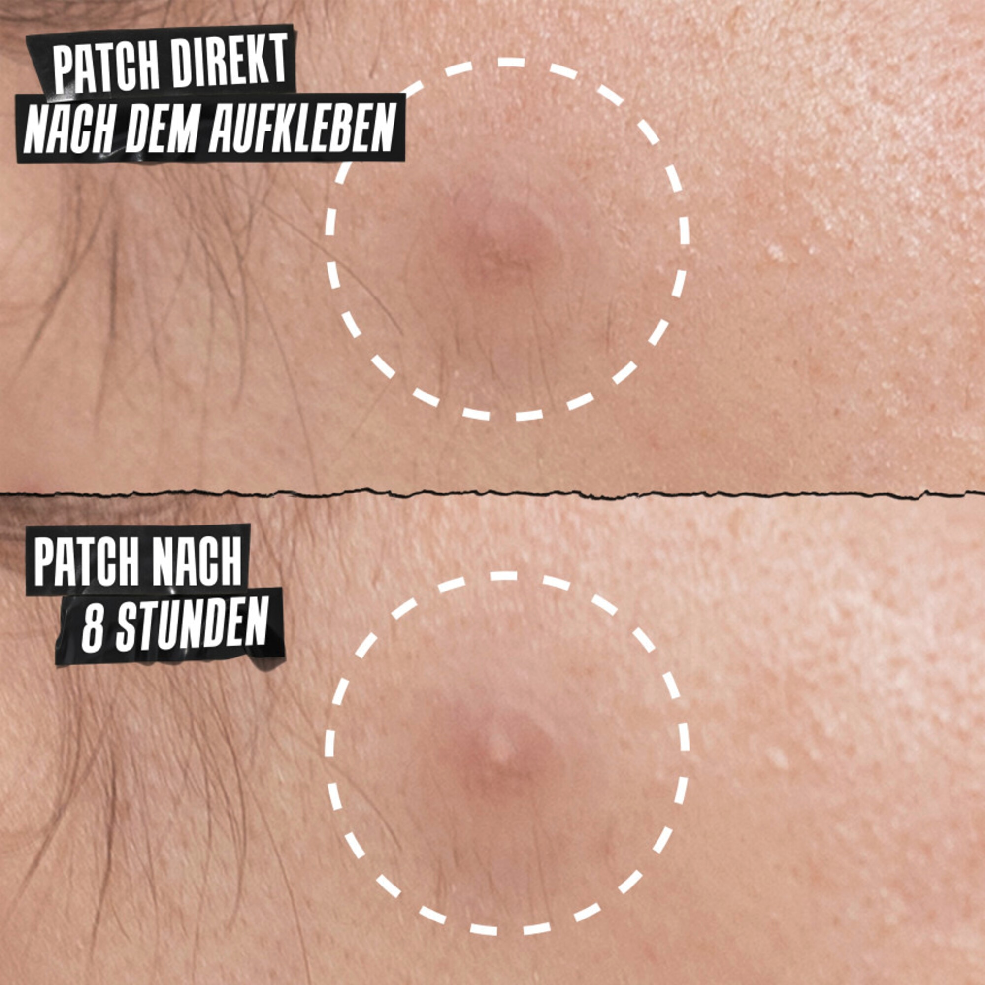 1 PCS Kiehl's Truly Targeted Overnight Blemish Patches Gesichtspflege 1 of 6