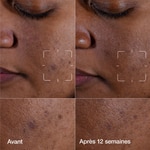 30 ML Clinique EVEN BETTER CLINICAL DARK SPOT CLEARING SERUM undefined  3 of 3 